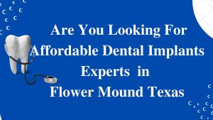 Finding Qualified Dental Implant Specialist in Flower Mound, Texas